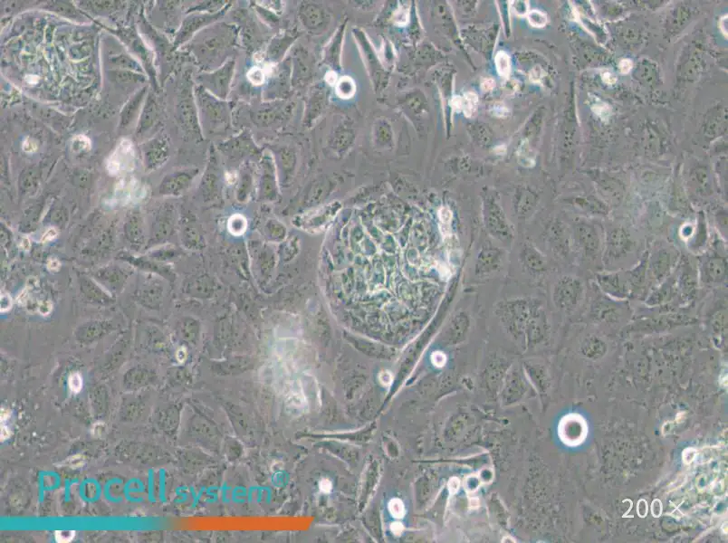 TR-LCC-1 Cell Complete Medium - 4