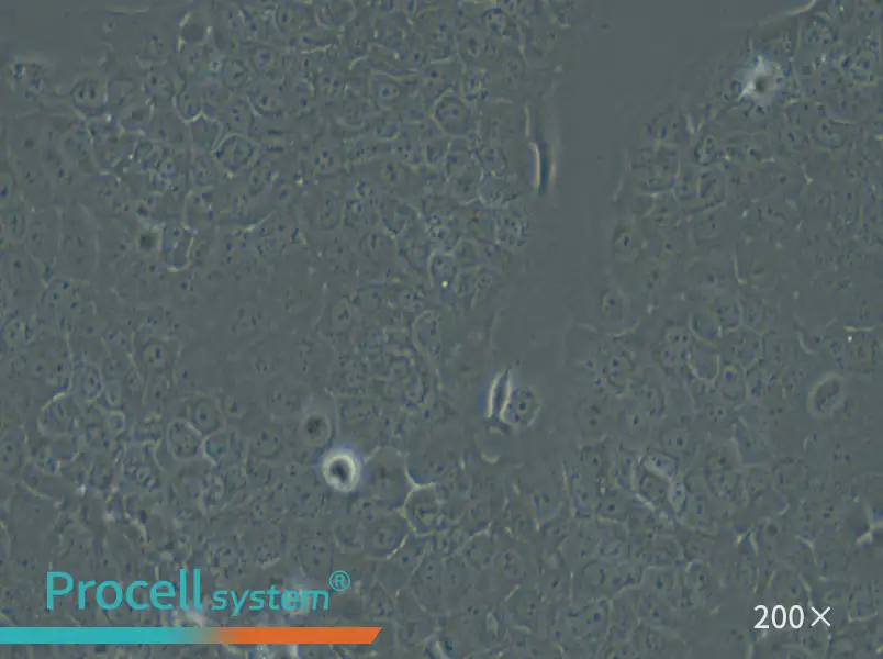 Ca Ski Cell Complete Medium - small - 4