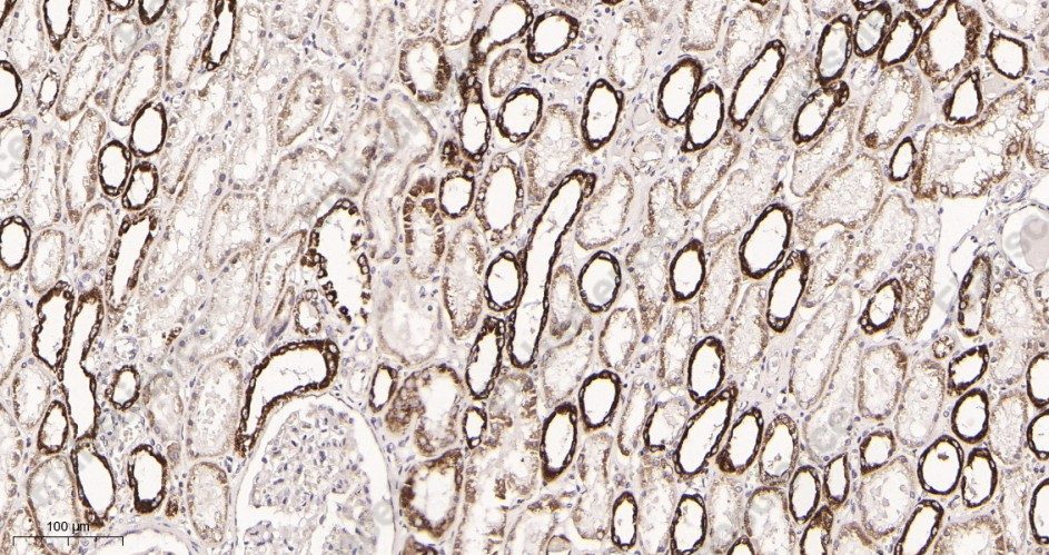 Recombinant MTCO2 Monoclonal Antibody - 3