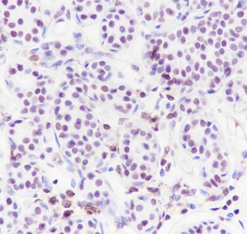 Recombinant CHD3 Monoclonal Antibody-searchlist-2