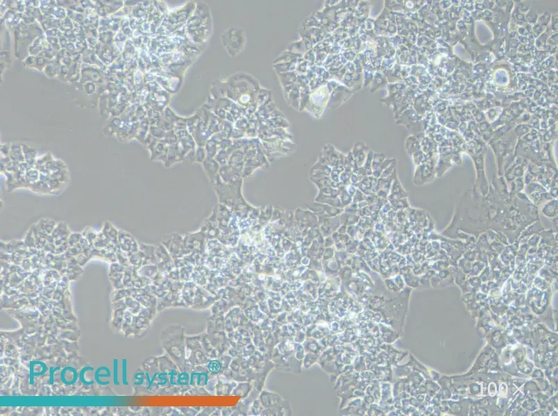 MUG-Chor1 Cell Complete Medium - 3