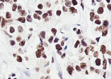 Recombinant MORF4L2 Monoclonal Antibody-searchlist-2