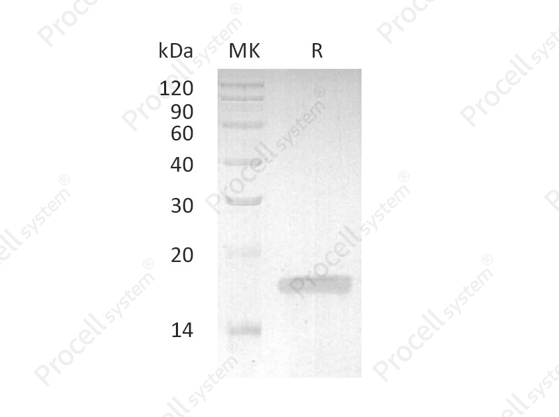 TNF-&alpha;/TNFA/TNFSF2, Rabbit, Recombinant