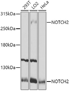 Western blot analysis of extracts of various cell lines using NOTCH2 Polyclonal Antibody at 1:1000 dilution.