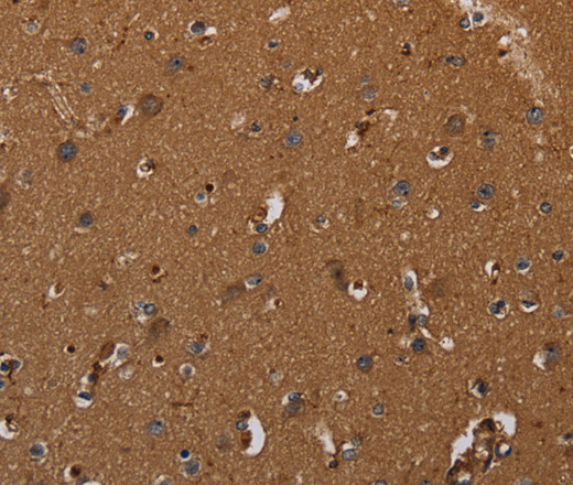 Immunohistochemistry of paraffin-embedded Human brain  tissue using CYBB Polyclonal Antibody at dilution 1:50