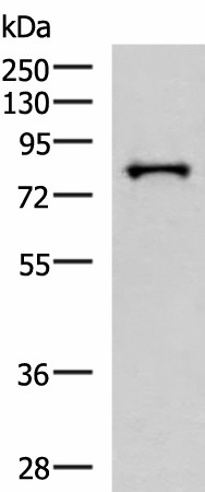 Western blot analysis of HepG2 cell lysate  using PRPF3 Polyclonal Antibody at dilution of 1:2000