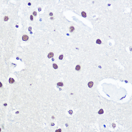 Immunohistochemistry of paraffin-embedded human brain using 53BP1 Polyclonal Antibody at dilution of 1:100 (40x lens).Perform high pressure antigen retrieval with 10 mM citrate buffer pH 6.0 before commencing with IHC staining protocol.