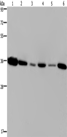 Western Blot analysis of 293T and MCF-7 cell, Human hepatocellular carcinoma tissue and Raji cell, A431 and A549 cell   using EMD Polyclonal Antibody at dilution of 1:1200