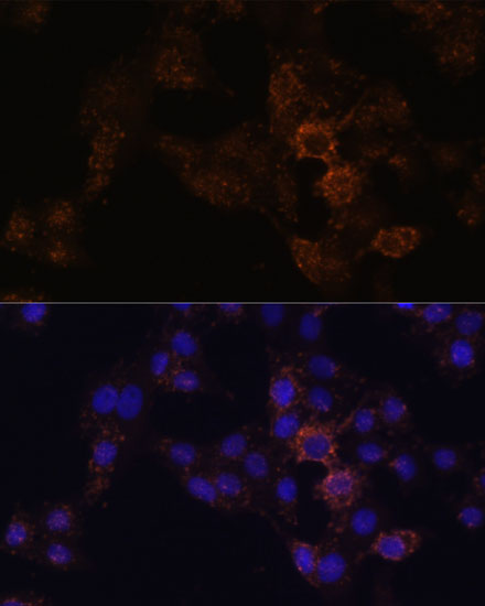 Immunofluorescence analysis of HeLa cells using GRP Polyclonal Antibody at dilution of  1:100. Blue: DAPI for nuclear staining.