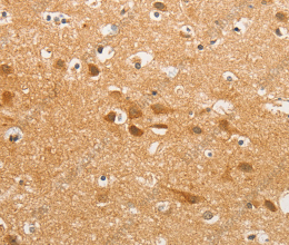 K-Cadherin Polyclonal Antibody - 2