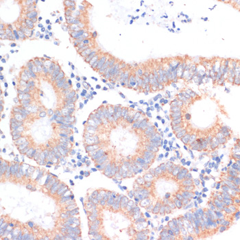 Immunohistochemistry of paraffin-embedded human colon carcinoma using eIF4EBP1 Polyclonal Antibody at dilution of 1:100 (40x lens).Perform microwave antigen retrieval with 10 mM PBS buffer pH 7.2 before commencing with IHC staining protocol.