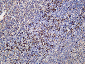 Recombinant DSG3 Monoclonal Antibody - 1