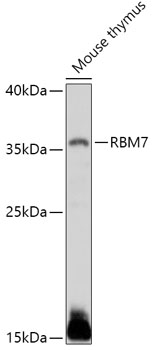 Western blot analysis of extracts of Mouse thymus using RBM7 Polyclonal Antibody at 1:1000 dilution.