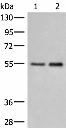 Western blot analysis of Human placenta tissue and 231 cell lysates  using HTRA4 Polyclonal Antibody at dilution of 1:400