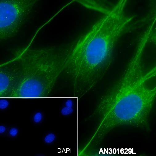 Recombinant PI3 Kinase p85 alpha Monoclonal Antibody - small - 4