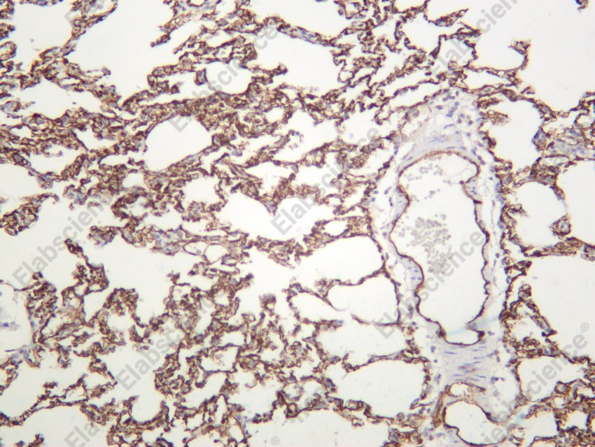 Recombinant CD31 Monoclonal Antibody - 5