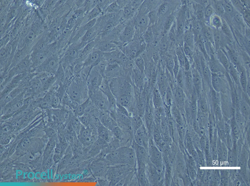 Human Cardiac Fibroblast Complete Medium - 5
