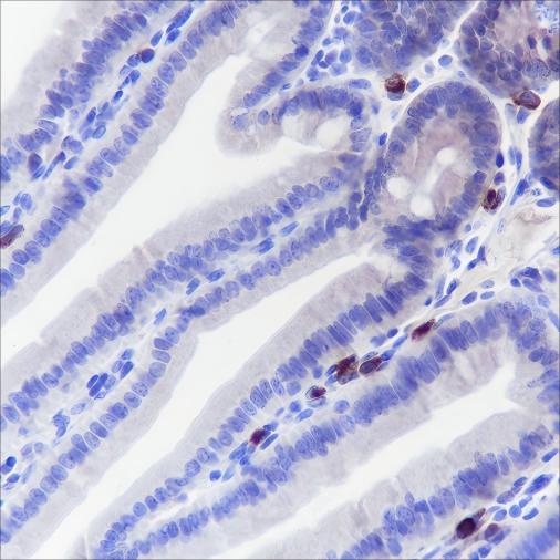 Recombinant GPNMB Monoclonal Antibody - small - 3