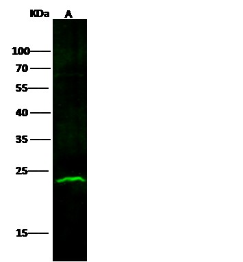 Recombinant ABHD14B Monoclonal Antibody - small - 2