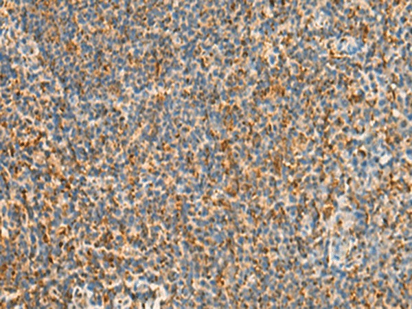 Immunohistochemistry of paraffin-embedded Human tonsil tissue  using STK32C Polyclonal Antibody at dilution of 1:40(?200)