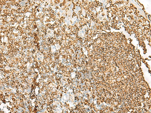 Immunohistochemistry of paraffin-embedded Human tonsil tissue  using HLA-DRB1 Polyclonal Antibody at dilution of 1:65(?200)