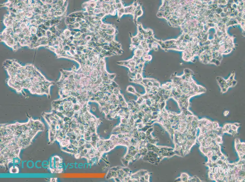 ZR-75-1 Cell Complete Medium - 6