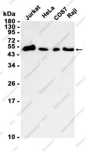 Recombinant PABPN1 Monoclonal Antibody - 1