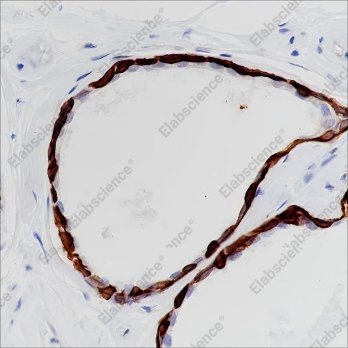 Recombinant Keratin 17 Monoclonal Antibody - 3
