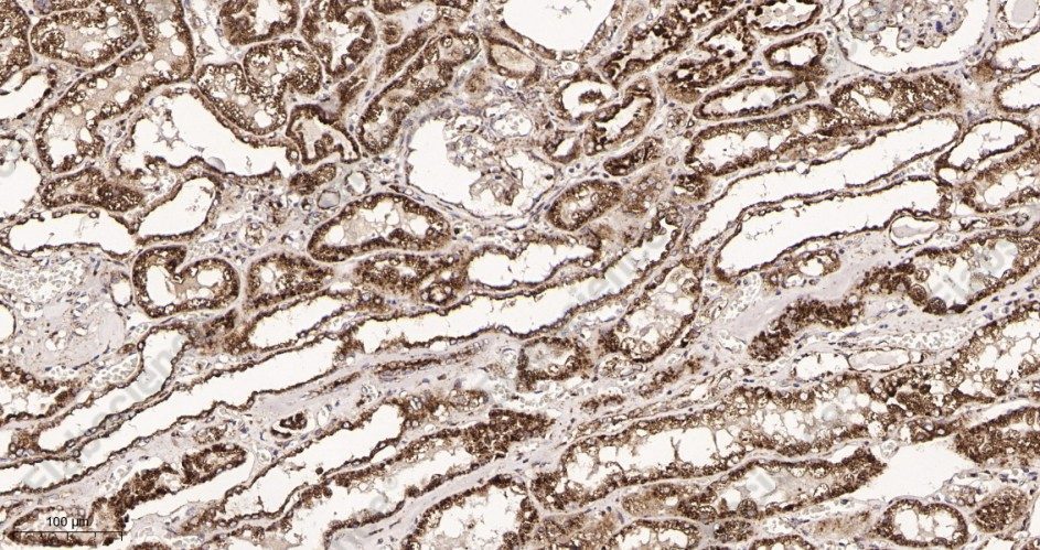 Recombinant LAMP2 Monoclonal Antibody - 2