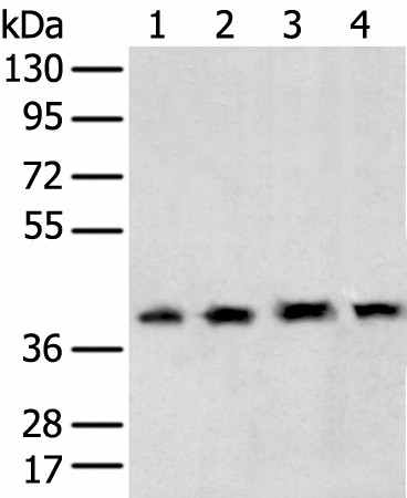 Western blot analysis of 231 cell Human testis tissue Hela and Hepg2 cell  using TBP Polyclonal Antibody at dilution of 1:400