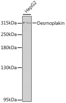 Western blot analysis of extracts of HepG2 cells using Desmoplakin Polyclonal Antibody at 1:800 dilution.