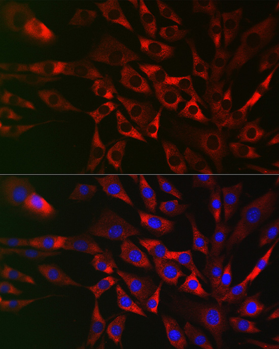Immunofluorescence analysis of NIH/3T3 cells using TRAF3IP2 Polyclonal antibody at dilution of 1:50 (40x lens). Blue: DAPI for nuclear staining.