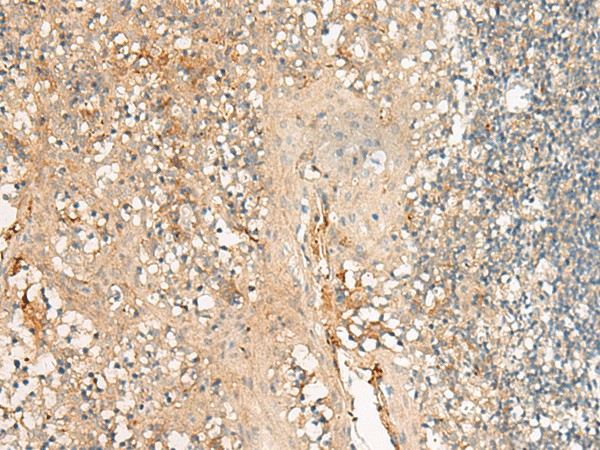 Immunohistochemistry of paraffin-embedded Human tonsil tissue  using GPR27 Polyclonal Antibody at dilution of 1:25(?200)