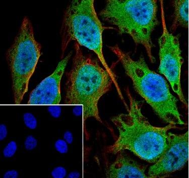 Recombinant IKK gamma Monoclonal Antibody-searchlist-2