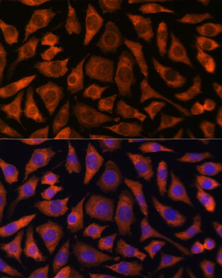 Immunofluorescence analysis of L929 cells using RABGGTA Polyclonal Antibody at dilution of 1:100. Blue: DAPI for nuclear staining.