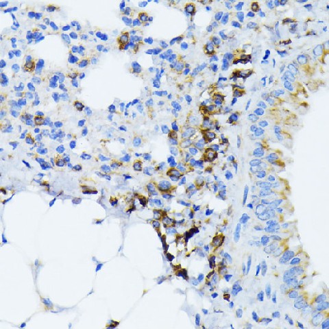 Immunohistochemistry of paraffin-embedded mouse lung using BiP/GRP78 Polyclonal antibody at dilution of 1:100 (40x lens).Perform microwave antigen retrieval with 10 mM PBS buffer pH 7.2 before commencing with IHC staining protocol.