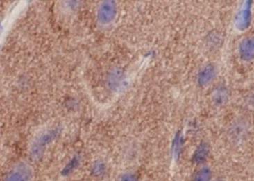 Recombinant Pan Trk Monoclonal Antibody-searchlist-2