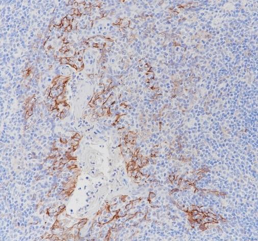 Recombinant PD-L1 Monoclonal Antibody - small - 3