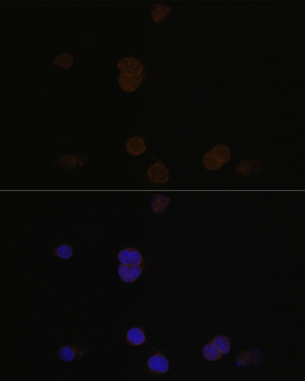 Immunofluorescence analysis of Y79 cells using RCVRN Polyclonal Antibody at dilution of 1:100. Blue: DAPI for nuclear staining.