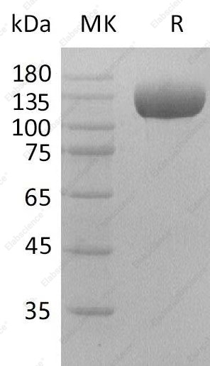 Recombinant Human DPP4/DPPIV/CD26 Protein (Fc Tag) - 1
