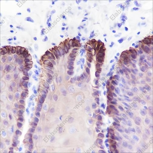 Recombinant Keratin 16 Monoclonal Antibody - 2