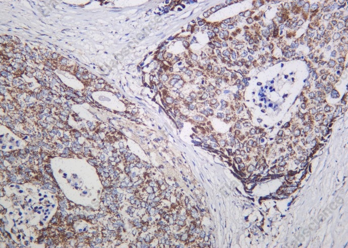 Recombinant NDUFS1 Monoclonal Antibody - 1