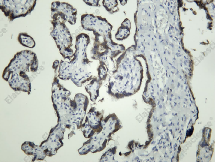 Recombinant GDF-15 Monoclonal Antibody - 1