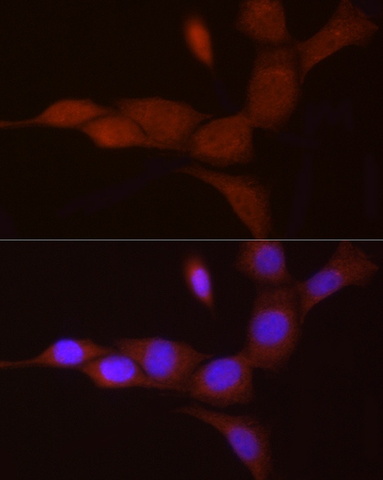 PGC1 alpha Polyclonal Antibody - small - 5
