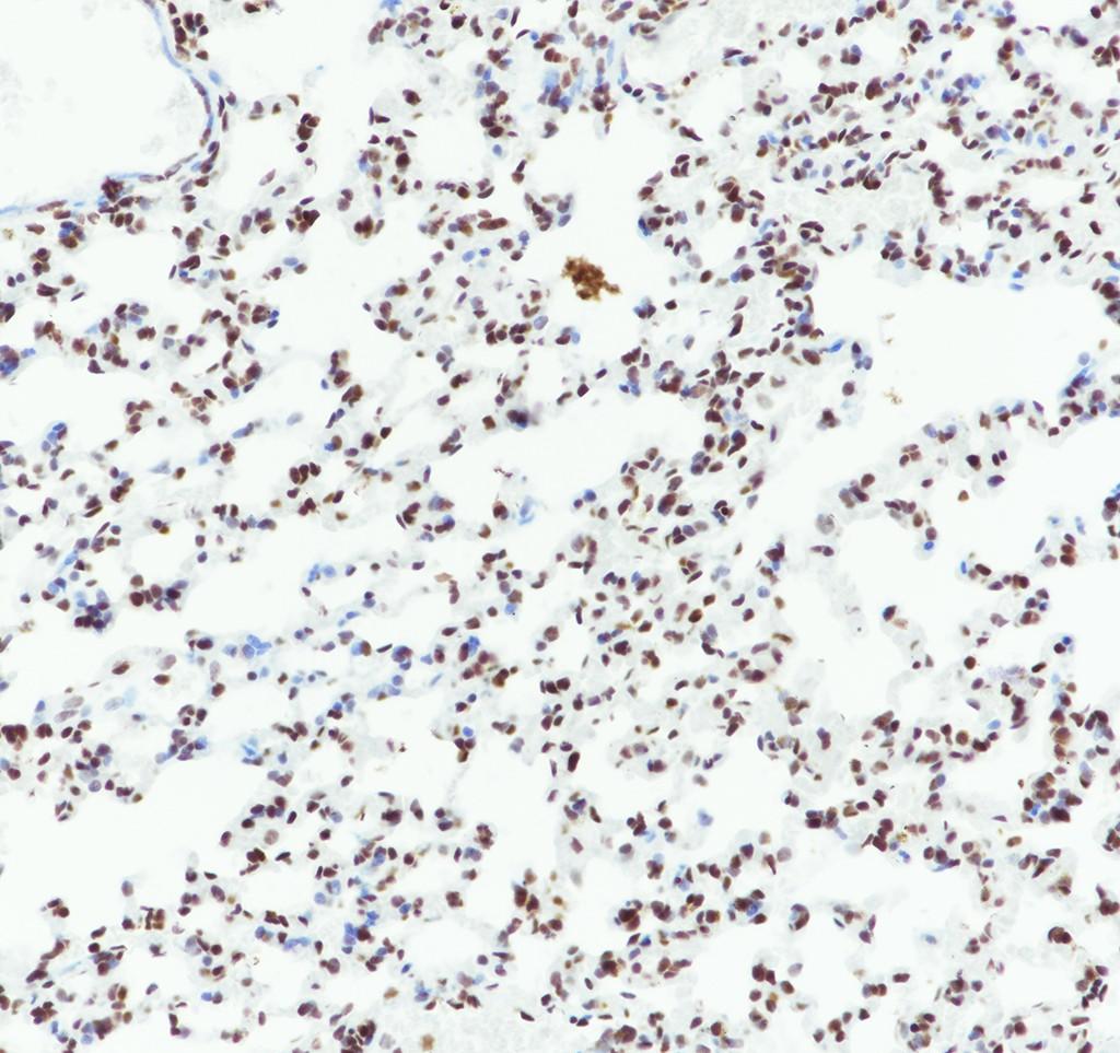 Recombinant RBBP7/RBBP4 Monoclonal Antibody - small - 4