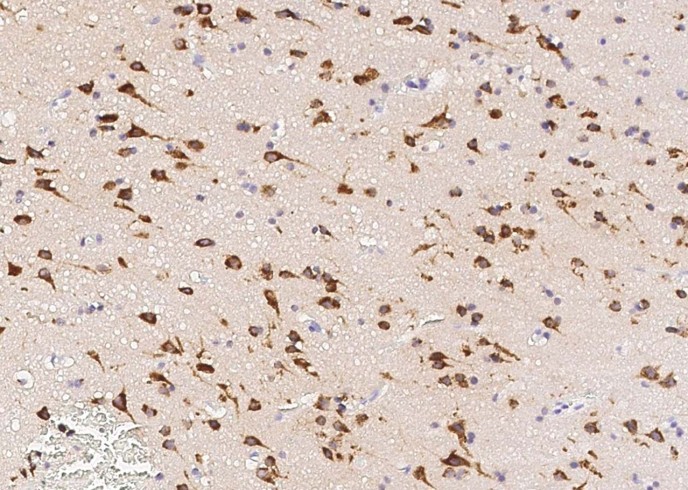Neuroserpin/SerpinI1 Monoclonal Antibody-searchlist-1