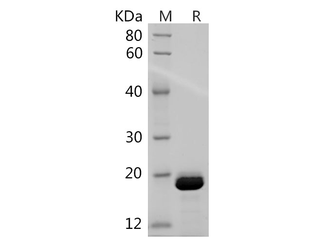 Recombinant Mouse IL-1 beta/IL1B Protein-1