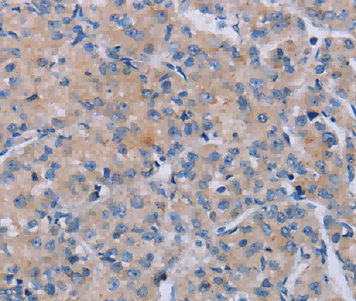 P2RX3 Polyclonal Antibody - 3