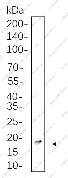 Recombinant Histone H3 (Tri Methyl Lys36) Monoclonal Antibody - 1