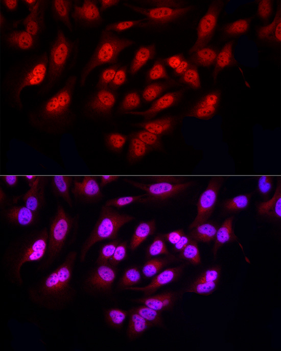 Immunofluorescence analysis of HeLa cells using FBXW11 Polyclonal antibody at dilution of 1:200 (40x lens). Blue: DAPI for nuclear staining.
